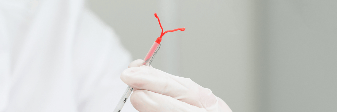 The Step-by-Step Guide to a Safe and Stress-Free IUD Removal