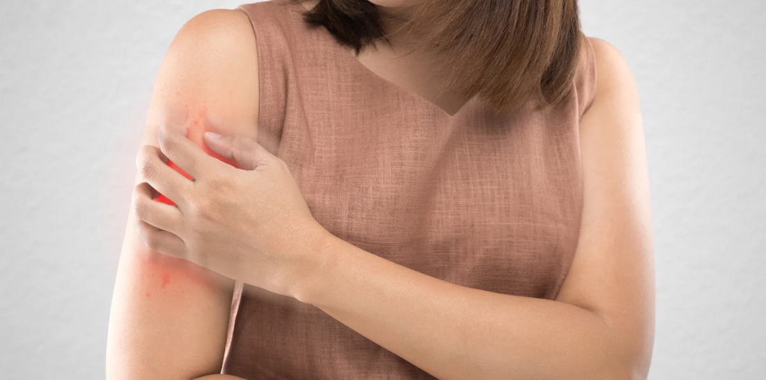 Woman scratching itchy arm.