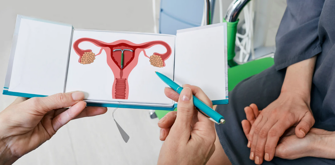 A doctor holds a diagram of a uterus with an IUD inserted, explaining the process to a patient.
