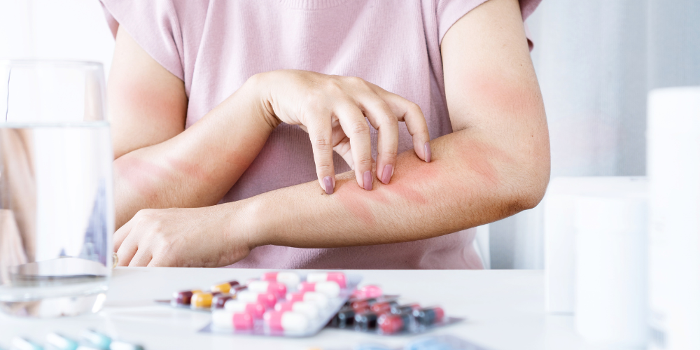 ﻿Scratching the Surface Dealing with Perimenopause Itching at Night