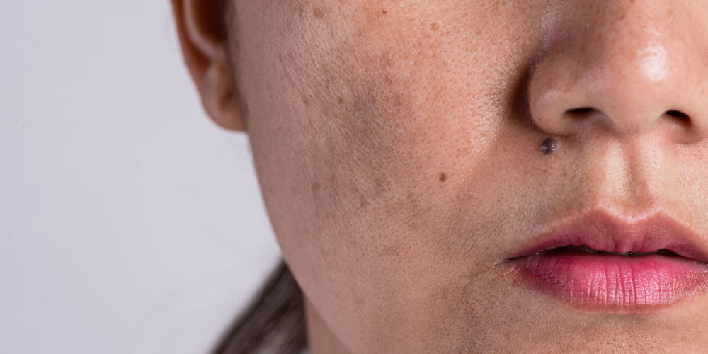 a woman's skin shown close up