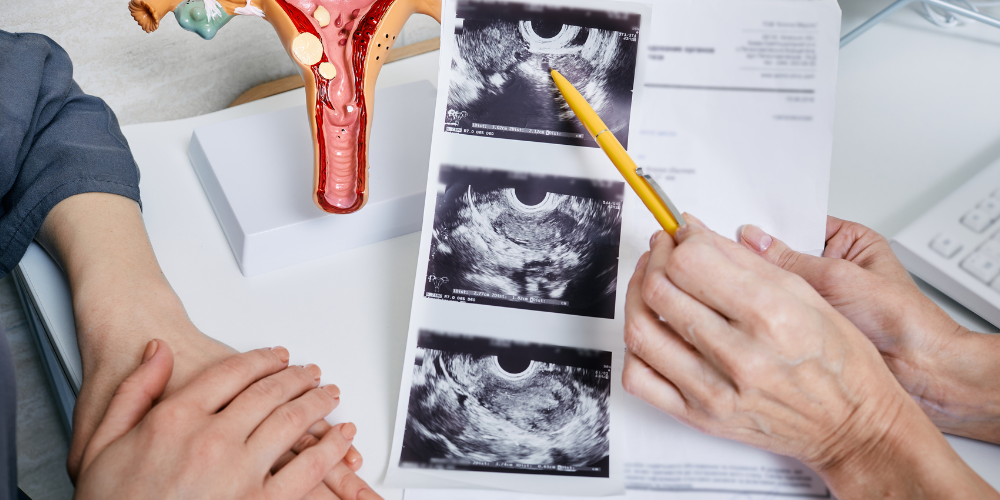 The image shows a person holding an xray.