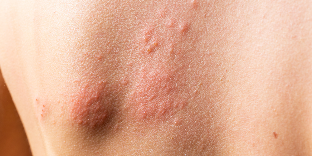 a close up of a person's skin condition